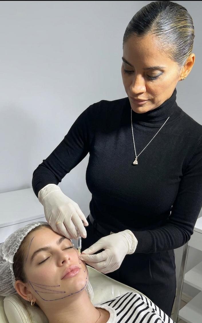 Aplicación de filler por la Dra. Soledad Suarez